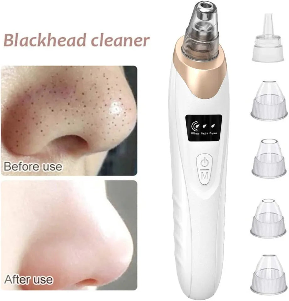 5 In 1 Blackhead Remover Machine Rechargeable Pore Cleaner - Skincare Device Designed For Pore Cleansing And Daily Beauty Routine (C)